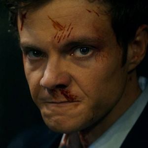 Foto Novocaine: Sin Dolor