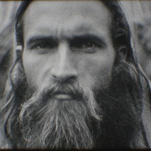 Foto Análisis de sangre azul