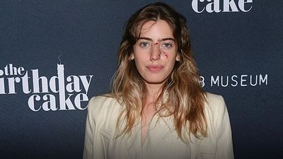 Clara McGregor fue mordida por un perro en el rostro y así acudió al estreno de 'The Birthday Cake' noticias imagen