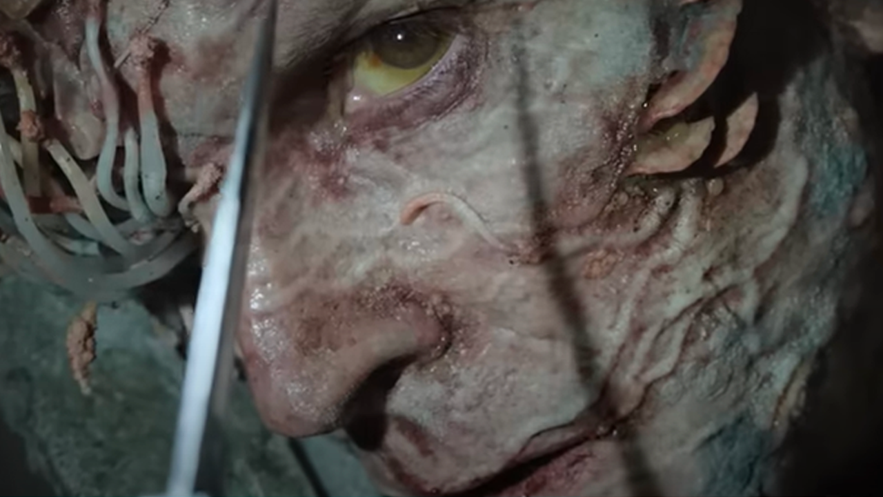 En el avance muestran a uno de los infectados.