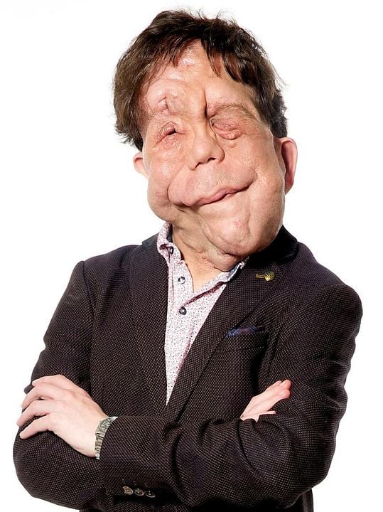 Póster Adam Pearson